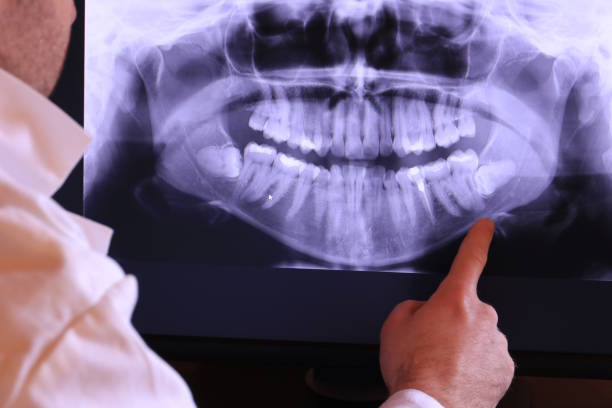 Best Emergency Tooth Extraction in Suamico, WI